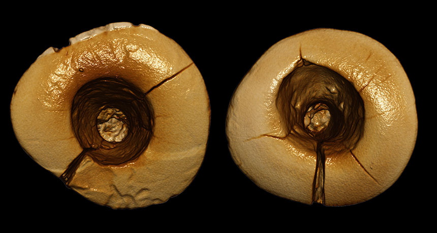 stone age dentistry