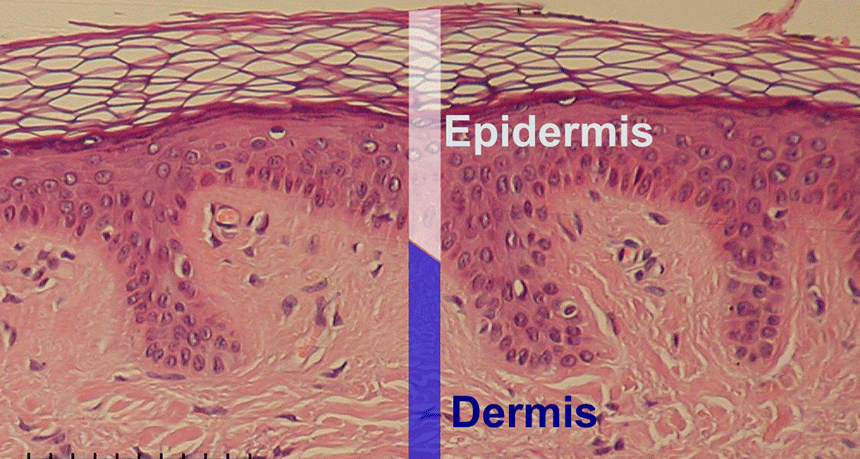 860-Epidermis-delimited-(1).gif