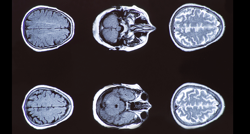 860-header-CT-scan-take2.gif