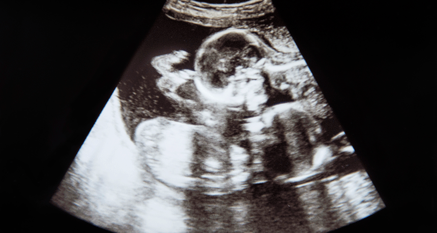 860-header-ultrasound.gif