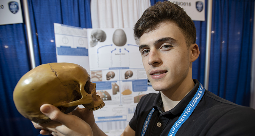 860_ISEF19_skull_sutures_AndreyGizdov.png