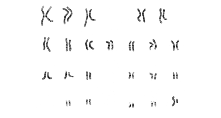 genome chromosome