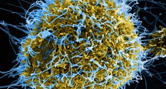 Ebola virus particles infecting cell