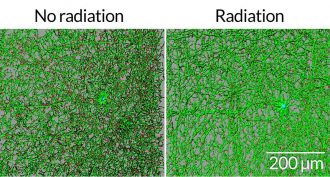 Mice data suggest that astronauts could suffer brain damage on the long trip to and from Mars. After being exposed to radiation, parts of nerve cells (green) in the brains of mice (right digital image) were shorter — and branched less — than in unexpo