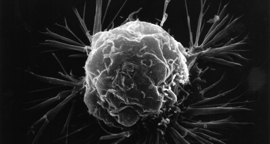 Cancer cell