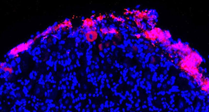 Cells extracted from bone marrow (pink) can deliver pain-relieving proteins to nerve cells in the spine (blue).