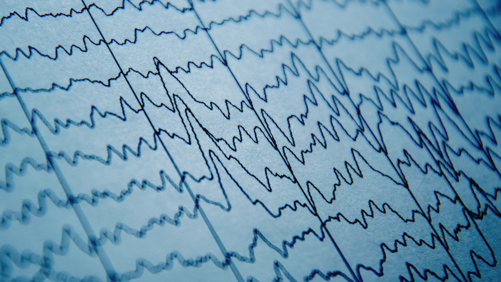 brainwaves EEG