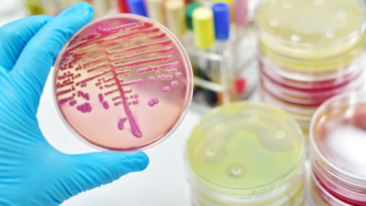 a blue gloved hand holding a petri plate with pink bacterial colonies growing on it