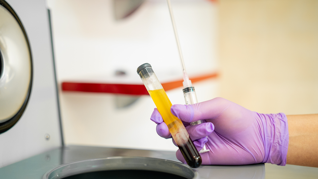 a photo of a gloved hand holding a vial of blood plasma