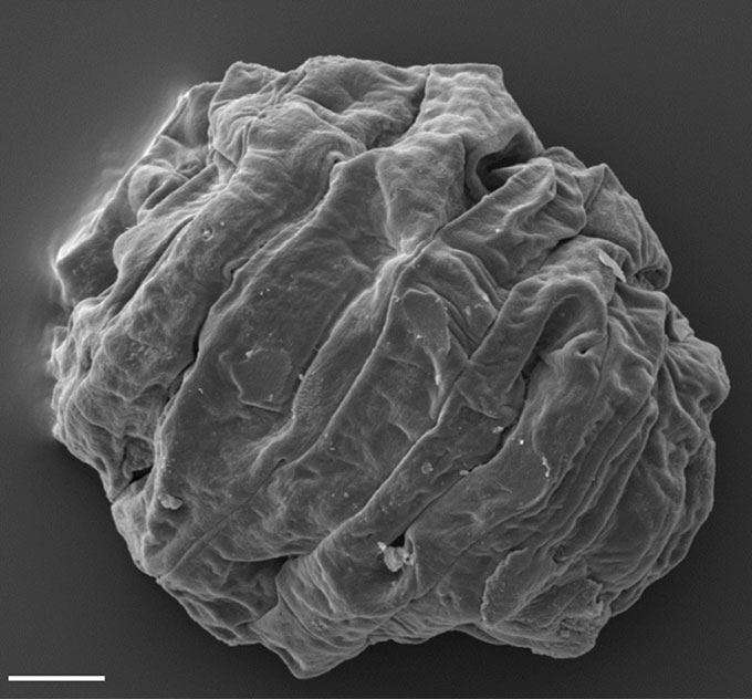 a microscopic image of a dried tardigrade, resembling a wrinkled ball