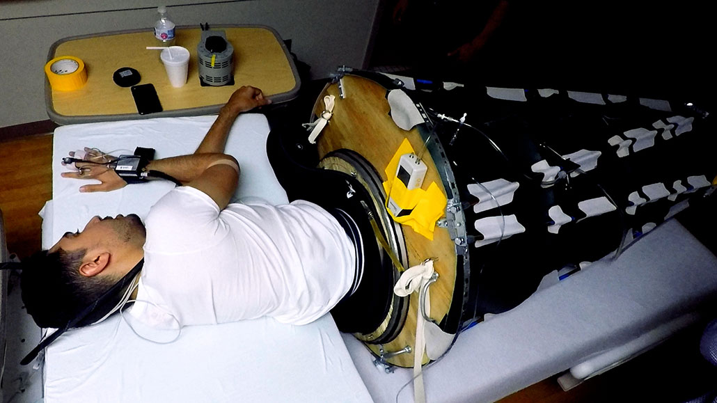 a photo of a man sleeping on a hospital bed, his lower half is encased in a cone
