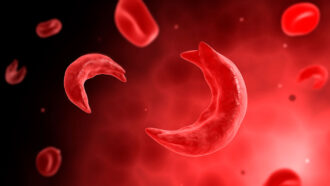 a computer illustration of sickle shaped blood cells tumbling in a blood stream