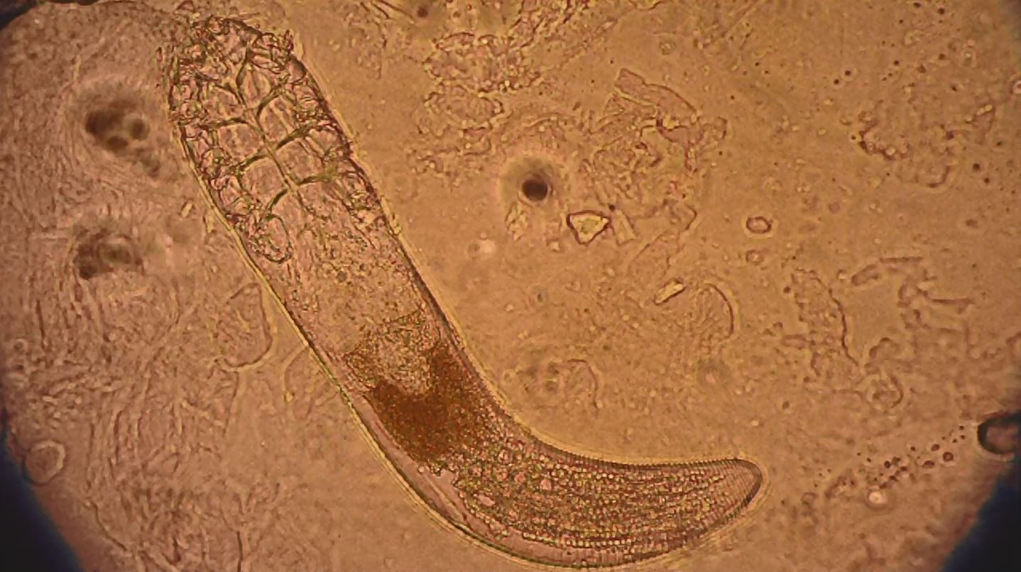 a microscope image shows the translucent outline of an worm-shaped organism