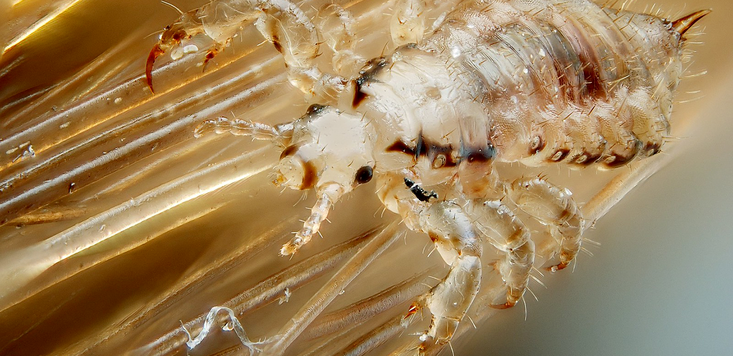 a microscopic image showing a human head louse on strands of hair
