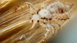 a microscopic image showing a human head louse on strands of hair
