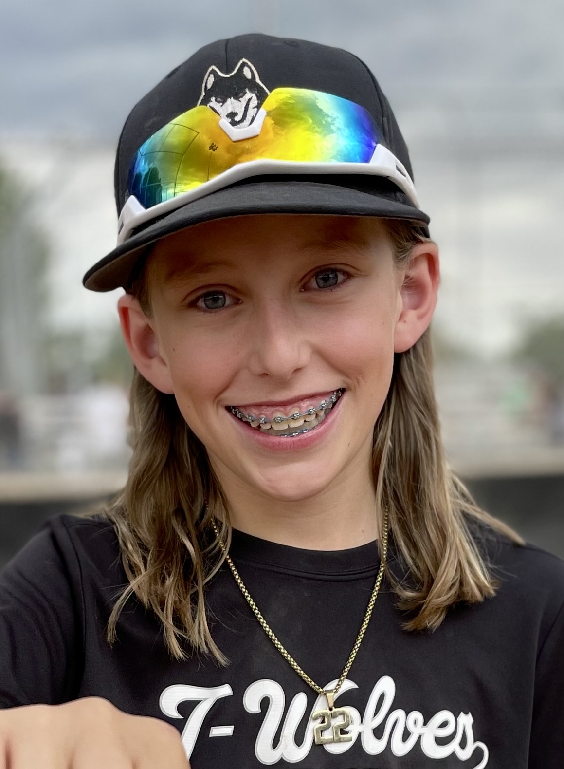 a boy with braces and shoulder length blonde hair wears a baseball cap