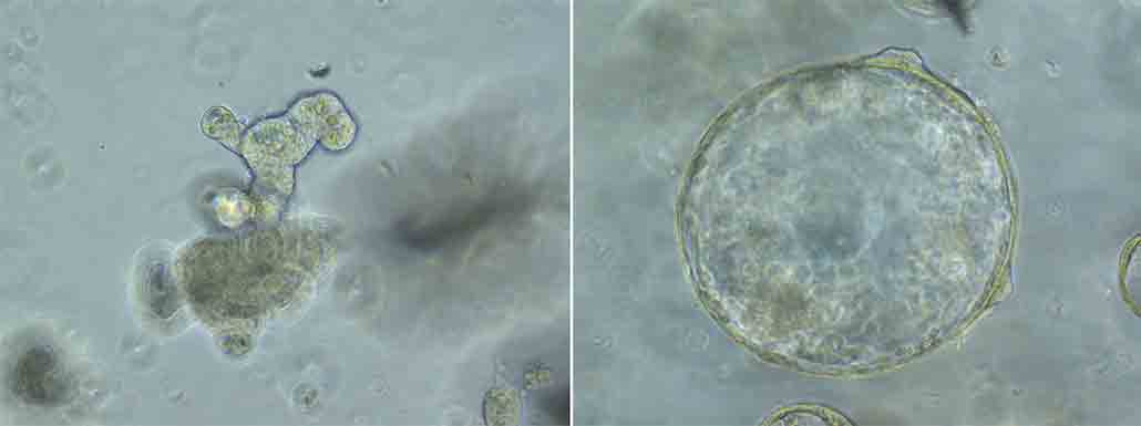 a photo of normal and abnormal growth in mouse cells