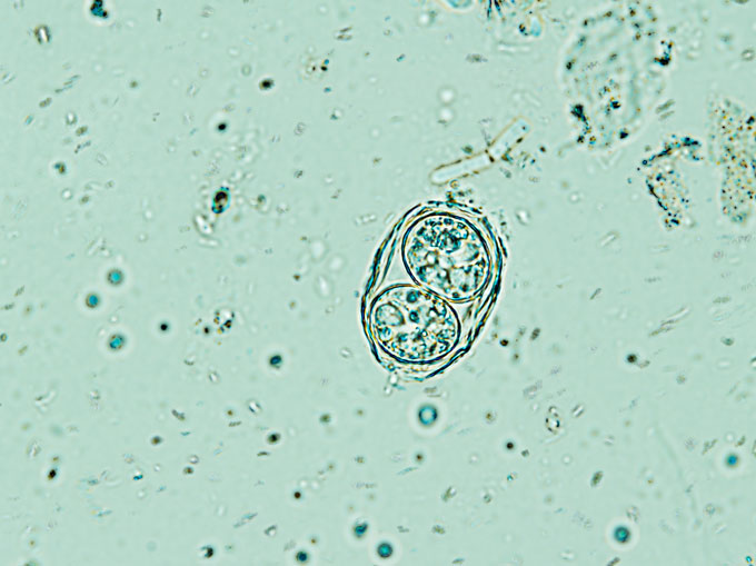 A microscope image of the Toxoplasma gondii parasite