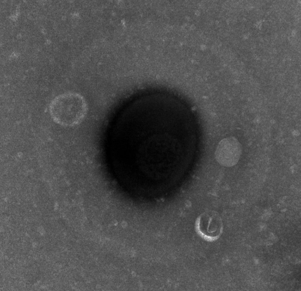 a black and white scanning electron micrograph showing a large black circle with several small circles clinging to the outside of it  Microplastic pollution aids viruses and prolongs their infectivity 1030 microplastics aid viruses electron micrograph