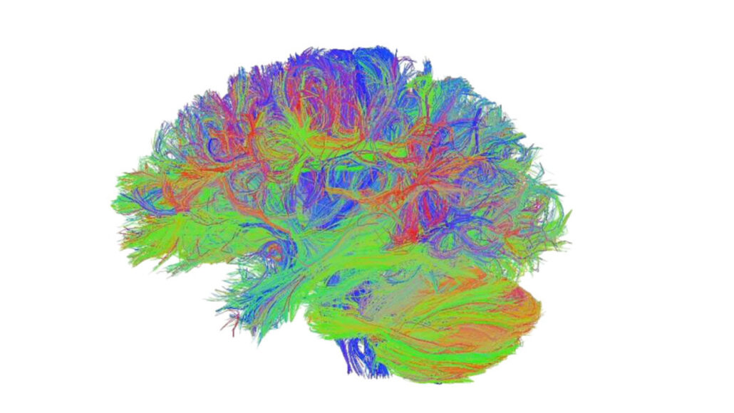 an illustration of a brain contains many small rainbow strands tangled around each other