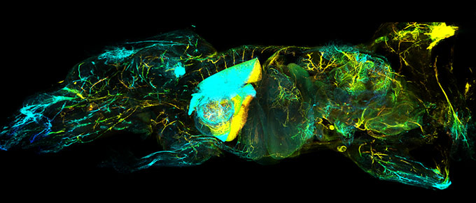An image of a mouse's lymphatic system. Blue indicates lymphatic vessels and organs that are closest to the camera, while yellow marks ones that are deeper inside the body.