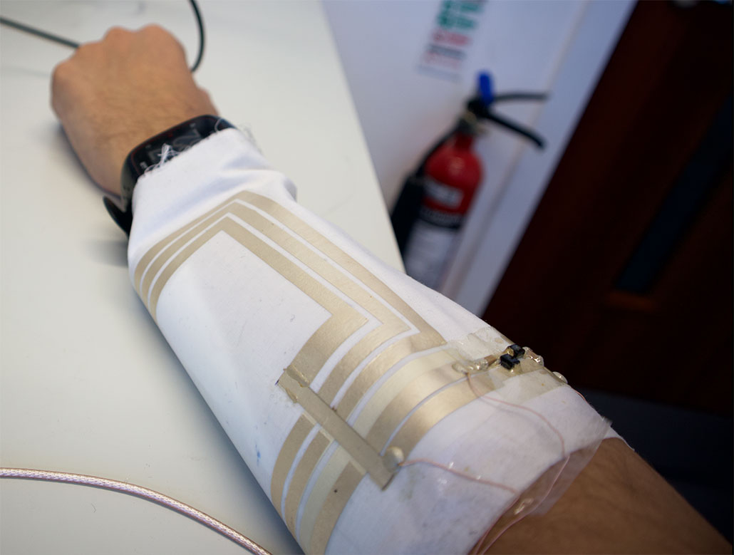 an arm lays across a white table, wrapped in a white sleeve from elbow to wrist