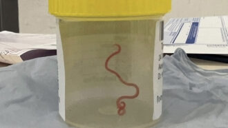 A photo of a living brain worm in a specimen jar.