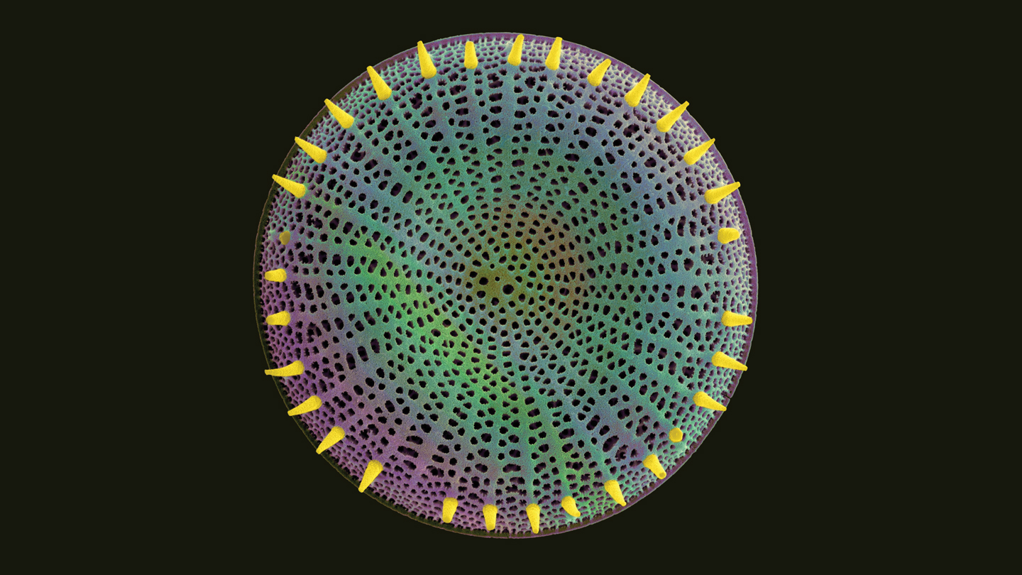 An image of a microscopic diatom which has a hard porous cell wall on a black background.