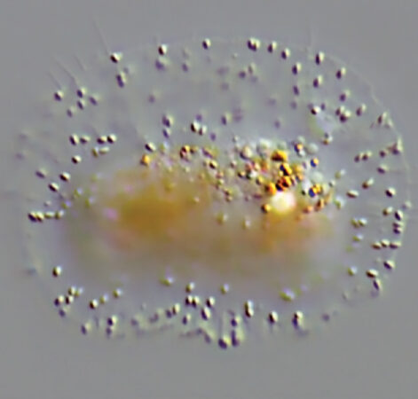 An image protist named Placopus melkoniani.