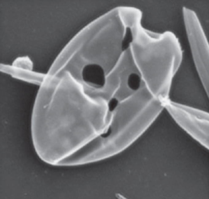 An image of holes in an algal cell created by members of the genus Placopus.