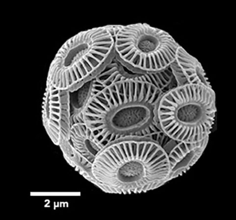 an electron micrograph image of a round protist covered in oval armored disks. Each disk resembles a smushed oval sun, with a central oval shape and rays that radiate out from that.