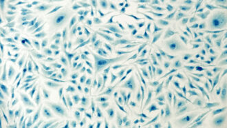 Cells appear as splotches in varying shades of blue.