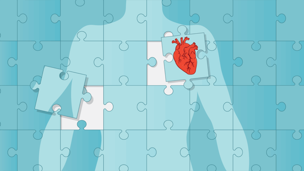a blue human torso outlined and divided into assembled puzzle pieces, the heart piece has been removed from it's slot for transplant