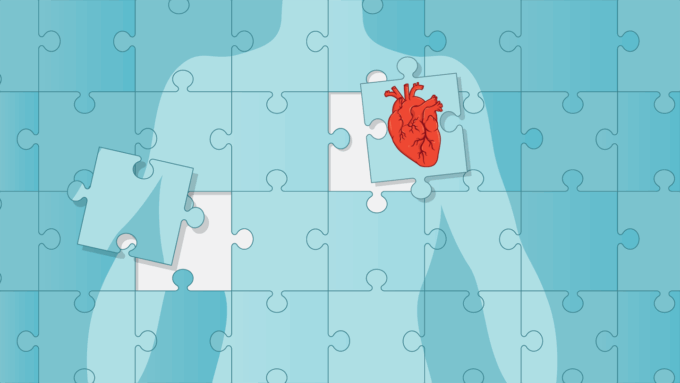 a blue human torso outlined and divided into assembled puzzle pieces, the heart piece has been removed from it's slot for transplant