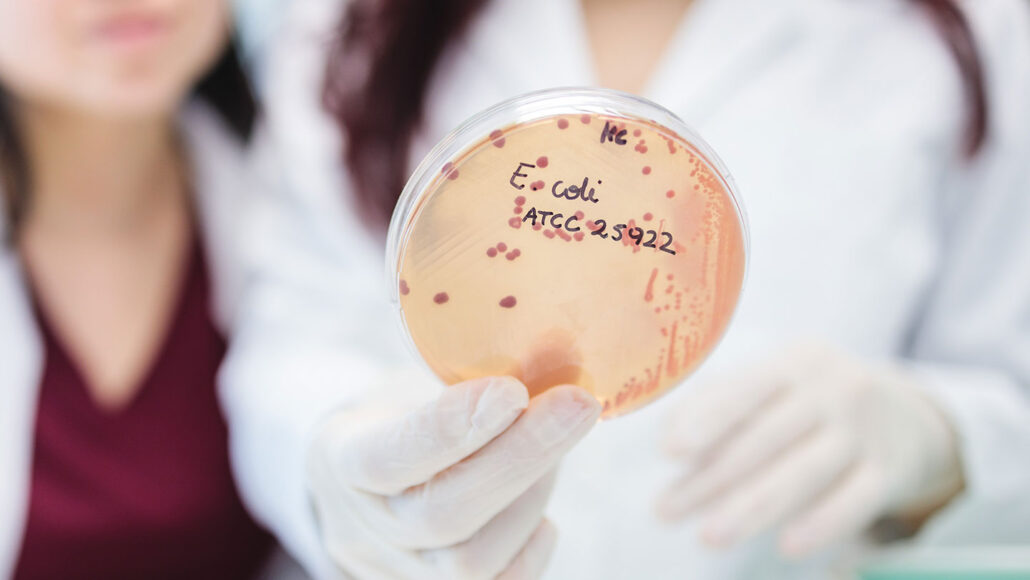 an agar plate showing bacterial cultures held by a person in a white coat and wearing sterile gloves