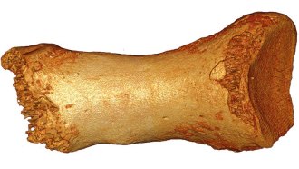 neanderthal bone