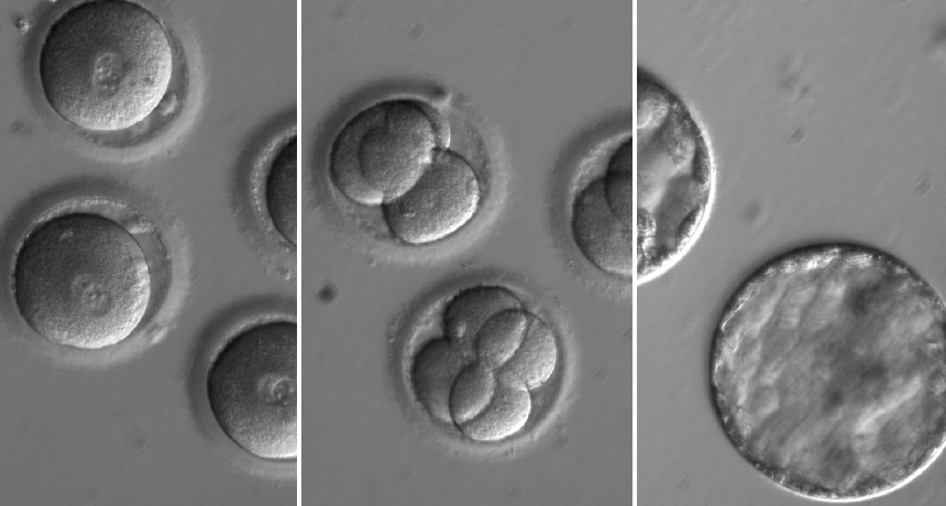 Molecular scissors fix disease-causing flaw in human embryos