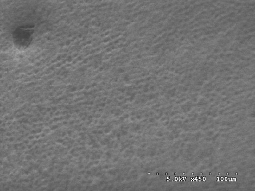 When viewed through a very powerful scanning electron microscope, the replacement tooth enamel that Stephen Le Breton, 17, created and bonded to a tooth resembles the skin of an orange. Credit: Stephen Le Breton