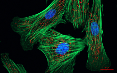 375_fibroblast_cells.png