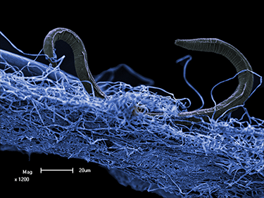375_inline_roundworms.png