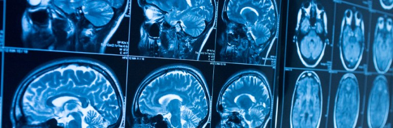 fMRI