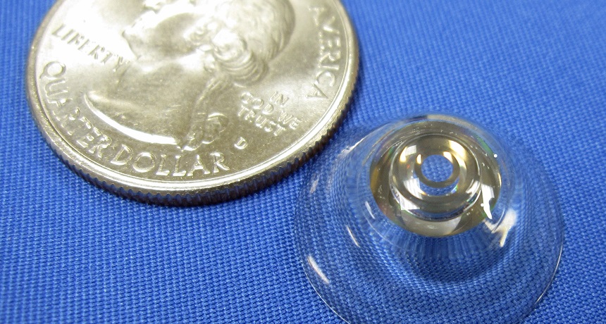 scleral contact lens