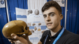 860_ISEF19_skull_sutures_AndreyGizdov.png