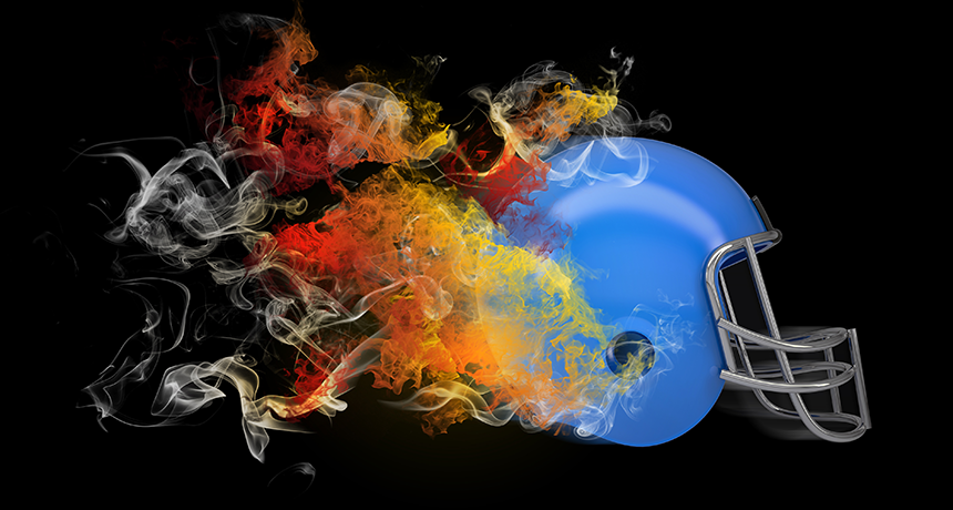 Concussion: More than ‘getting your bell rung’