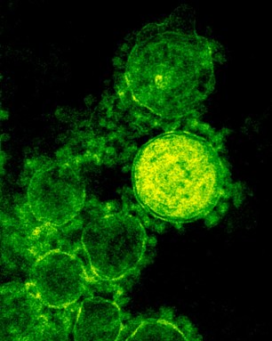 Microscopic photo of the new germ, shown in false color. Credit: NIAID/NIH