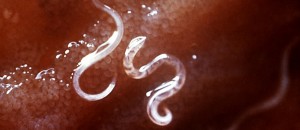 Hookworms