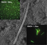 Last year, scientists discovered a kind of oil-eating bacteria, shown in this picture, in the plumes of oil rising from the floor of the Gulf of Mexico.