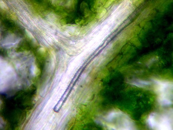 A bubble like the slender one within this walnut tree leaf can be bad news. When a tree experiences the stress of a drought, these bubbles pop up. Too many of them can kill a tree. Credit: Dr. Hervé Cochard (INRA, Clermont-Ferrand, France)