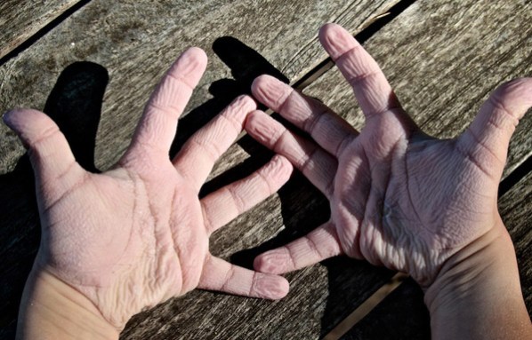 Immerse your hands in water for a while, and wrinkles will form. Those wrinkles improve a person’s grip on wet, slippery objects, says a new study. Credit: Mitchio/Flickr