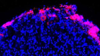 Cells extracted from bone marrow (pink) can deliver pain-relieving proteins to nerve cells in the spine (blue).